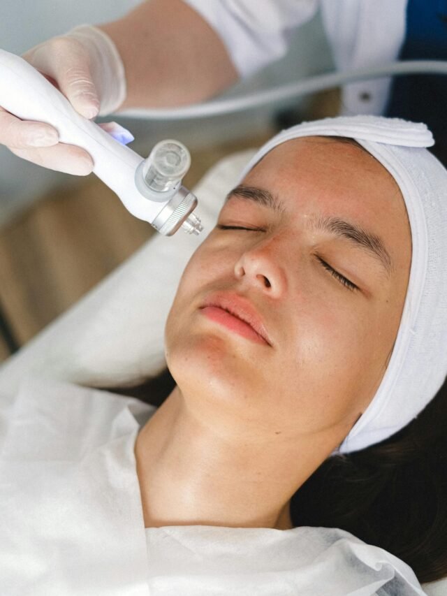 Laser Resurfacing on Face: Everything You Need to Know